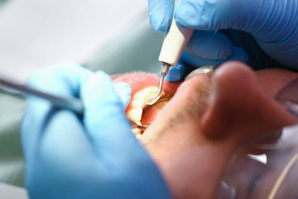 Best Urgent Dental Care for Toothache in Rosewood Heights, IL