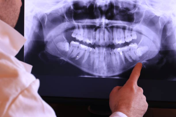 Best Broken or Cracked Tooth Emergency Dentist in Rosewood Heights, IL