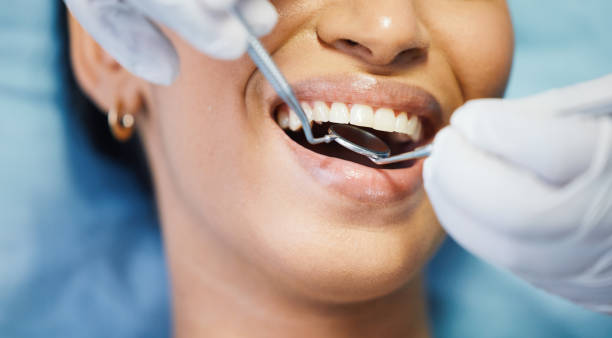 Best Emergency Dentist for Lost Fillings or Crowns in Rosewood Heights, IL