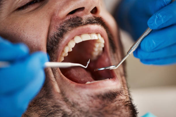 Best Emergency Dental Services for Seniors in Rosewood Heights, IL