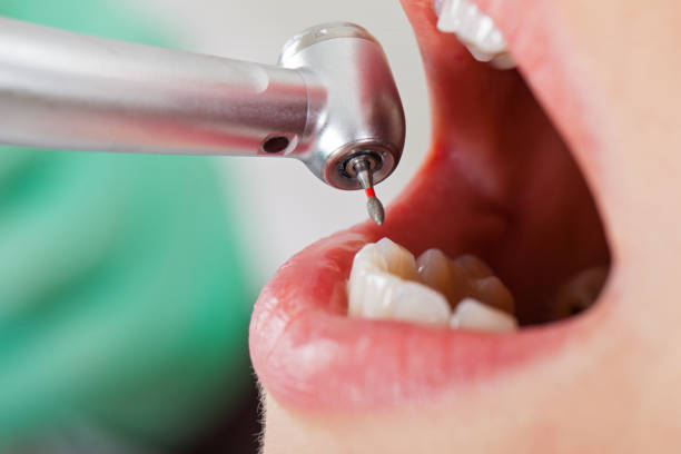 Best Weekend Emergency Dentist in Rosewood Heights, IL
